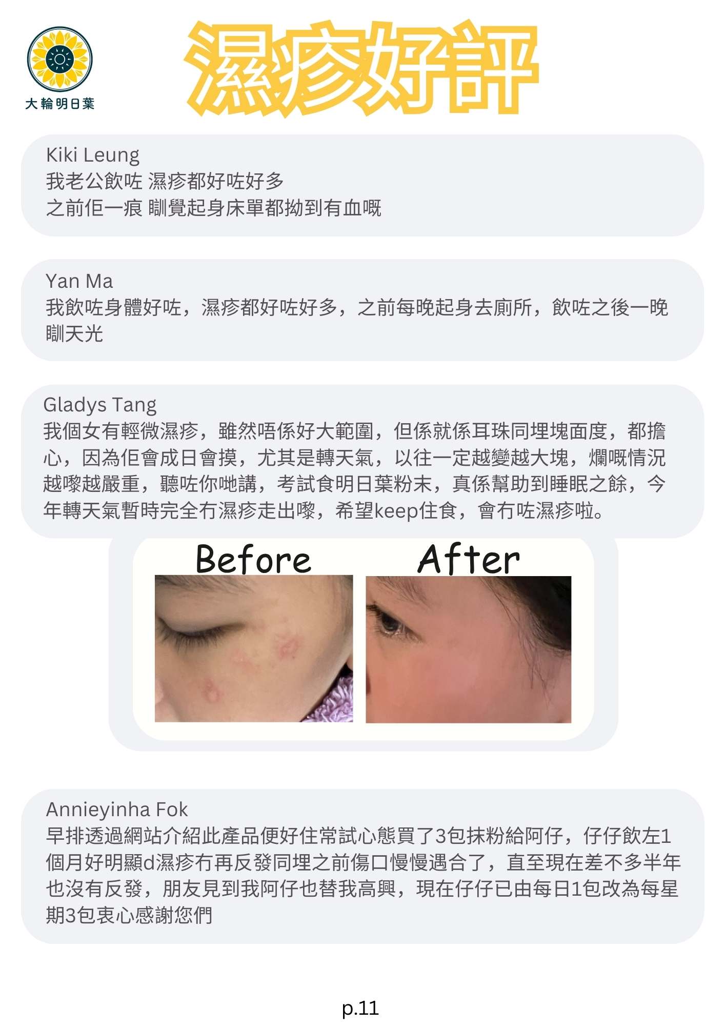 我老公飲咗 濕疹都好咗好多
之前佢一痕 瞓覺起身床單都拗到有血嘅

瞓天光
我飲咗身體好咗，濕疹都好咗好多，之前每晚起身去廁所，飲咗之後一晚

我個女有輕微濕疹，雖然唔係好大範圍，但係就係耳珠同埋塊面度，都擔心，因為佢會成日會摸，尤其是轉天氣，以往一定越變越大塊，爛嘅情況越嚟越嚴重，聽咗你哋講，考試食明日葉粉末，真係幫助到睡眠之餘，今年轉天氣暫時完全冇濕疹走出嚟，希望keep住食，會冇咗濕疹啦